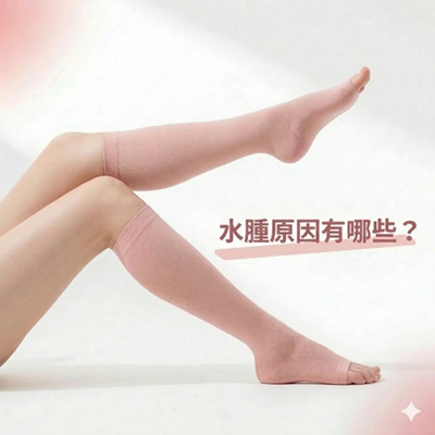 水腫原因有哪些？腿部腫脹常見問題解析